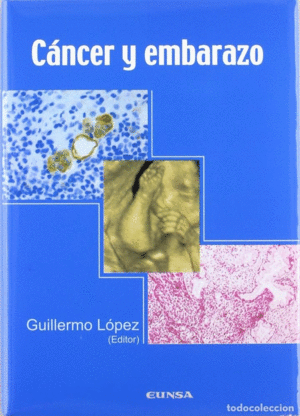CANCER Y EMBARAZO