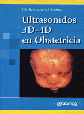 ULTRASONIDOS 3D 4D EN OBSTETRICIA